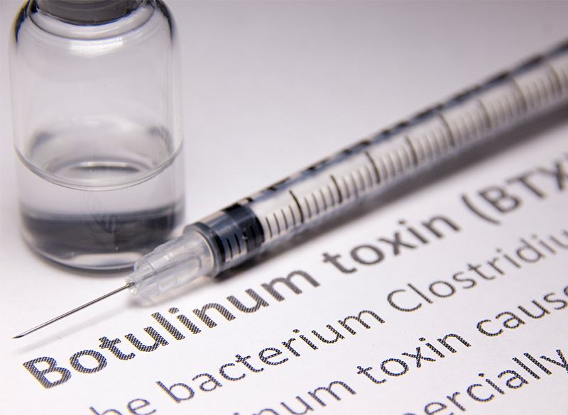 ボツリヌス治療